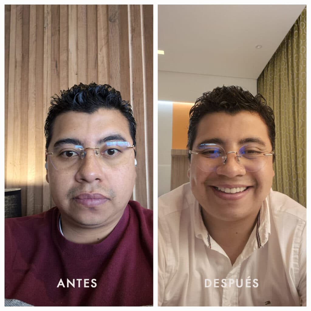 Antes y después 1
