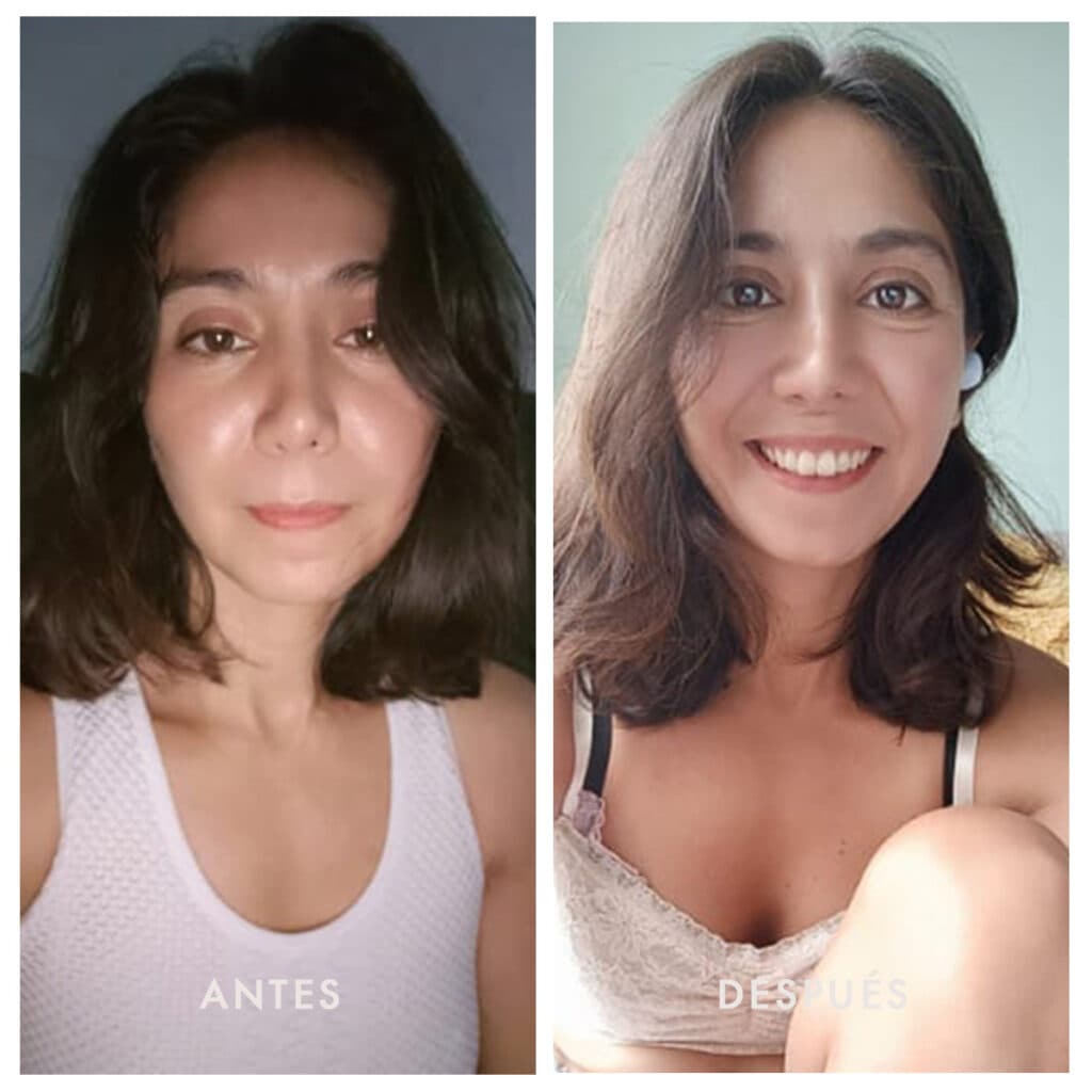 Antes y después 2