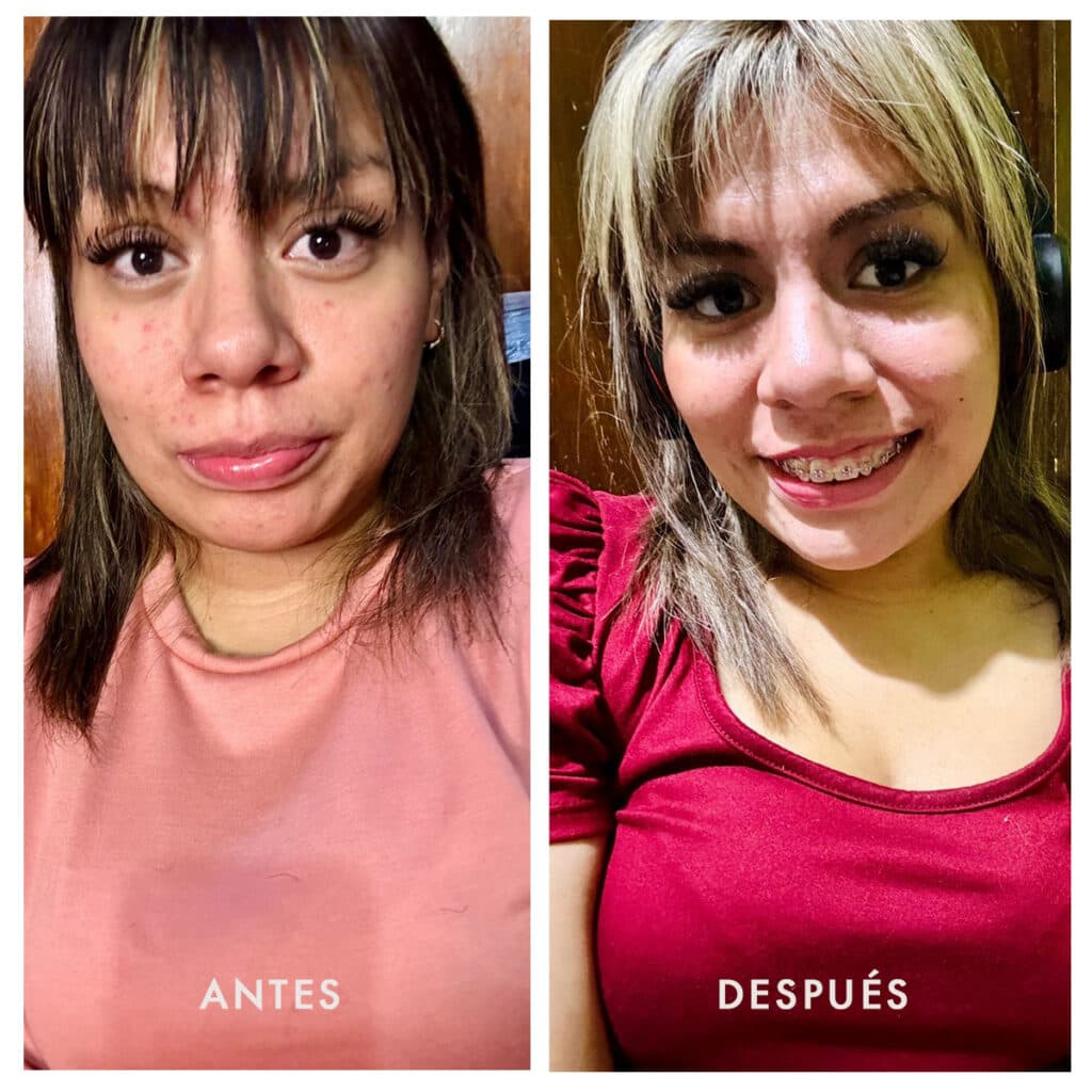 Antes y después 3