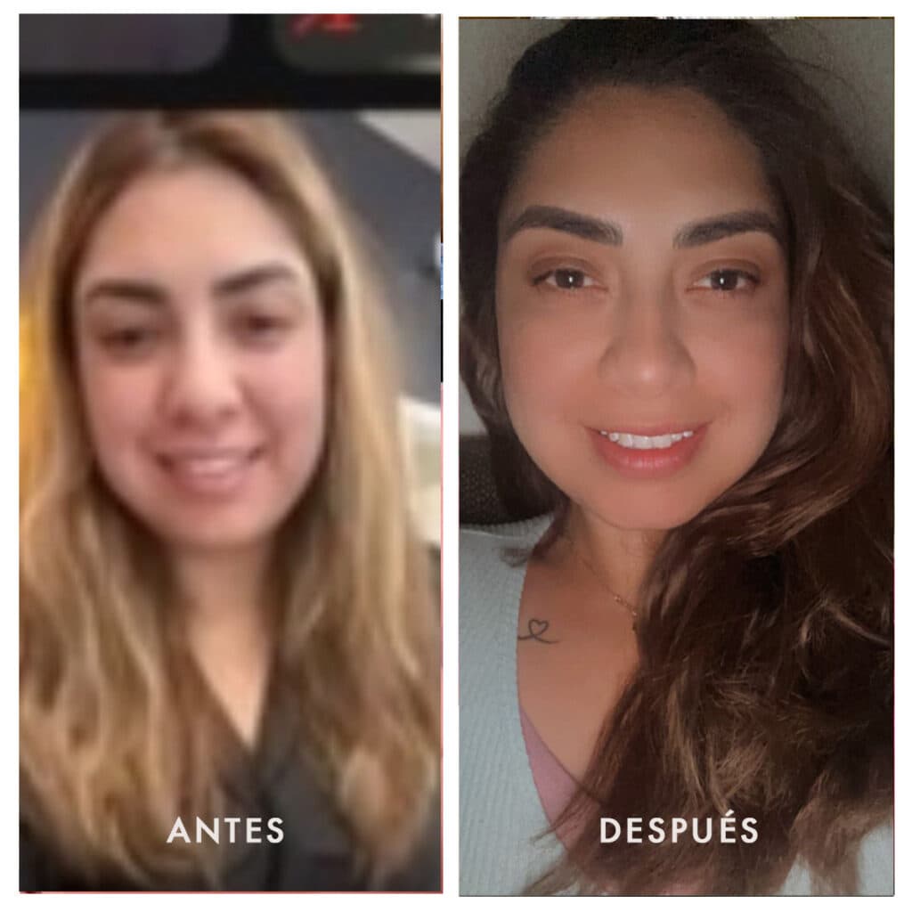 Antes y después 4