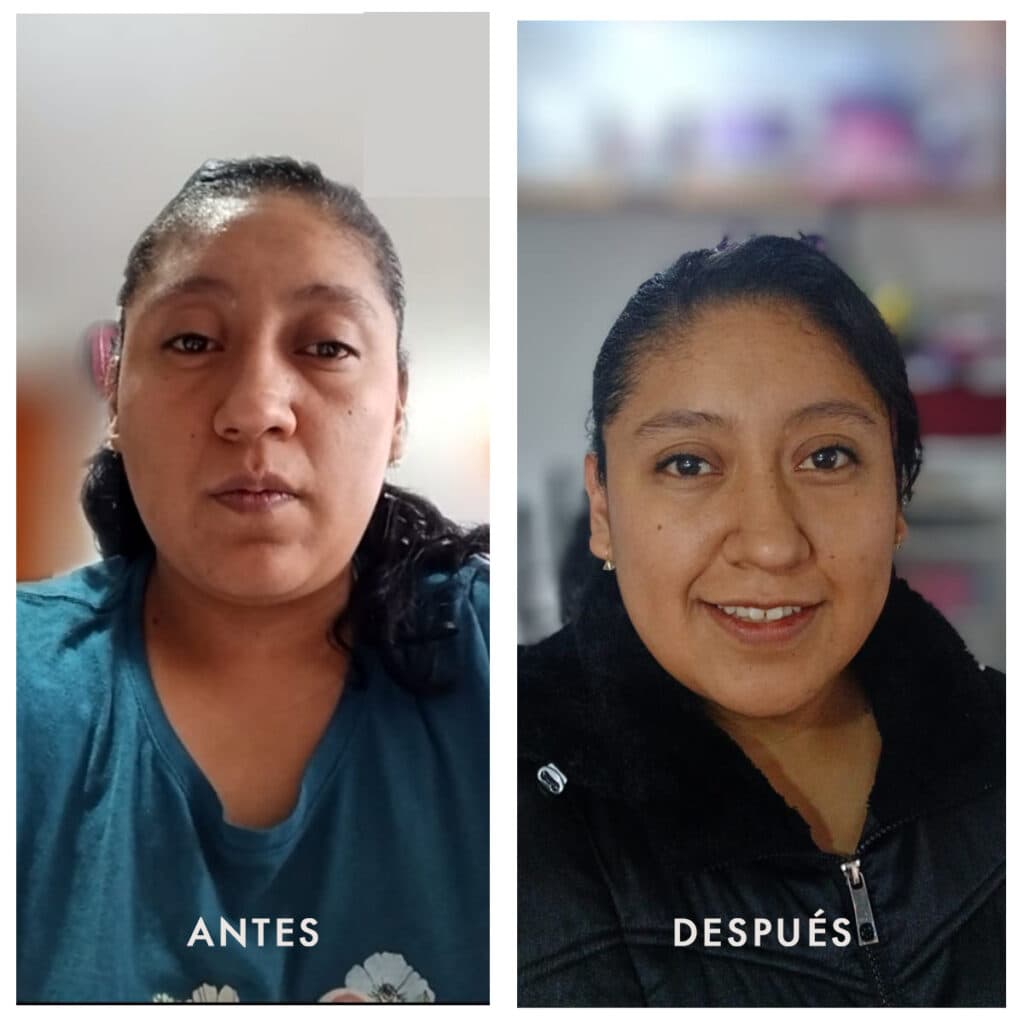 Antes y después 5